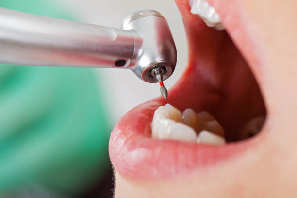 Best Weekend Emergency Dentist in Bear Creek Ranch, TX
